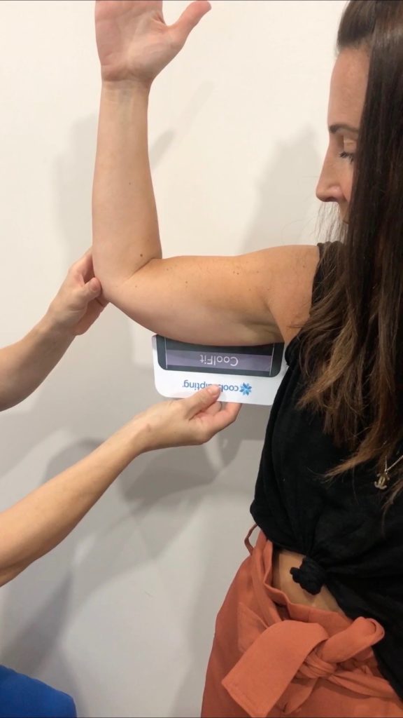 CoolSculpting: Say Buh-Bye to Flappy Arms